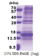 NDP (25-133, His-tag) Human Protein