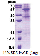 TINAGL1 (22-467, His-tag) Human Protein