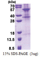 TINAGL1 (22-467, His-tag) Human Protein