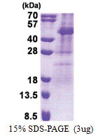 TSSK2 (1-358, His-tag) Human Protein