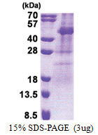 TSSK2 (1-358, His-tag) Human Protein