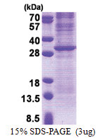 Granzyme K (GZMK) (27-264, His-tag) Human Protein