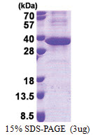 LRG1 (36-347, His-tag) Human Protein