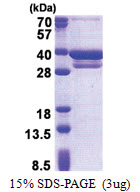 CUEDC2 (1-287, His-tag) Human Protein