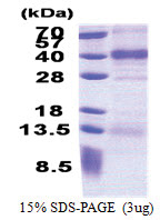 Follistatin-related protein 1 (21-308, His-tag) Human Protein