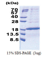 PAF (1-111, His-tag) Human Protein