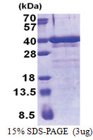 ZNF346 (1-294, His-tag) Human Protein