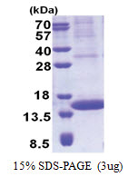 PIP / GCDFP15 (29-146, His-tag) Human Protein