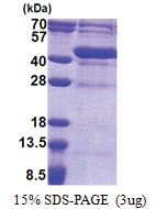 Uracil phosphoribosyltransferase (UPRT) (1-309, His-tag) Human Protein