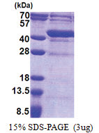 Uracil phosphoribosyltransferase (UPRT) (1-309, His-tag) Human Protein