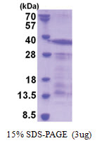 CD43 / Leukosialin (20-253, His-tag) Human Protein