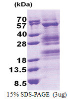 TADA3L (1-432, His-tag) Human Protein