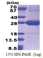 NDUFV2 (33-249, His-tag) Human Protein
