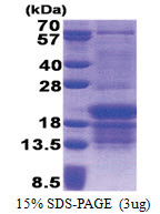 PCBP1 (1-163, His-tag) Human Protein