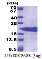 Prothymosin alpha (1-110, His-tag) Human Protein