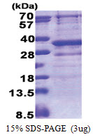 GIMAP5 (1-284, His-tag) Human Protein