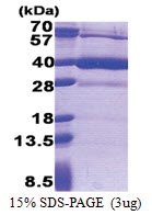HS3ST1 / 3OST (21-307, His-tag) Human Protein