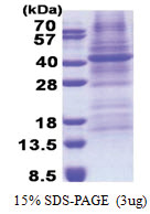 Fucosyltransferase 3 (35-361, His-tag) Human Protein