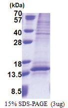 UQCRQ (1-82, His-tag) Human Protein UQCRQ (1-82, His-tag) Human Protein