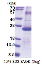 DUSP26 (1-211, His-tag) Human Protein