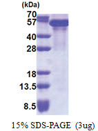TIF1-beta / TRIM28 (366-802, His-tag) Human Protein