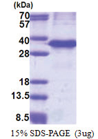 Cathepsin Z (62-303, His-tag) Human Protein