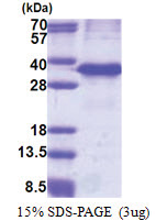 Cathepsin Z (62-303, His-tag) Human Protein
