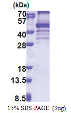EBNA1BP2 (1-306, His-tag) Human Protein