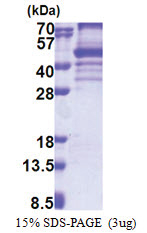 EBNA1BP2 (1-306, His-tag) Human Protein