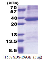 PPP1R3B (1-285, His-tag) Human Protein