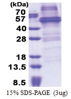 NOB1 (1-412, His-tag) Human Protein
