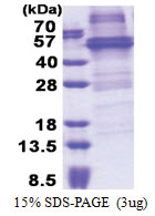 NOB1 (1-412, His-tag) Human Protein