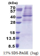 AMPK gamma-1 chain / AMPKg (1-331, His-tag) Human Protein