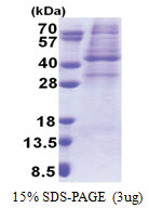 AMPK gamma-1 chain / AMPKg (1-331, His-tag) Human Protein