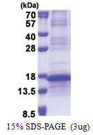 RPL35A (1-110, His-tag) Human Protein