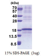 RPL34 (1-117, His-tag) Human Protein