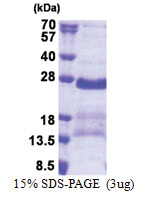 GAGE2A (1-116, His-tag) Human Protein