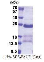 GAGE2A (1-116, His-tag) Human Protein