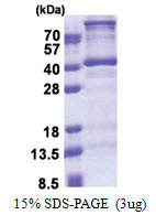DNTTIP1 (1-329, His-tag) Human Protein