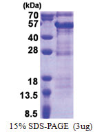 DBR1 (228-544, His-tag) Human Protein