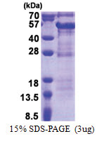 DBR1 (228-544, His-tag) Human Protein