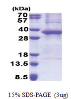 ASB8 (1-288, His-tag) Human Protein