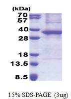 ASB8 (1-288, His-tag) Human Protein