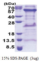 TIPIN (1-301, His-tag) Human Protein