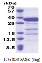 Syntaxin 6 / STX6 (1-234, His-tag) Human Protein