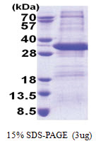 Syntaxin 17 / STX17 (1-229, His-tag) Human Protein