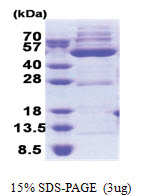 OXSM (28-459, His-tag) Human Protein