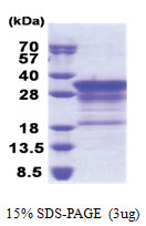 Myelin Basic (1-197, His-tag) Human Protein