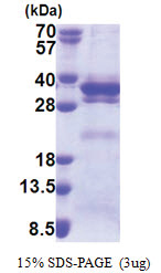 LRRC59 (1-244, His-tag) Human Protein