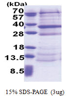 DCUN1D4 (1-292, His-tag) Human Protein